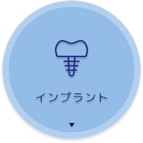 インプラント