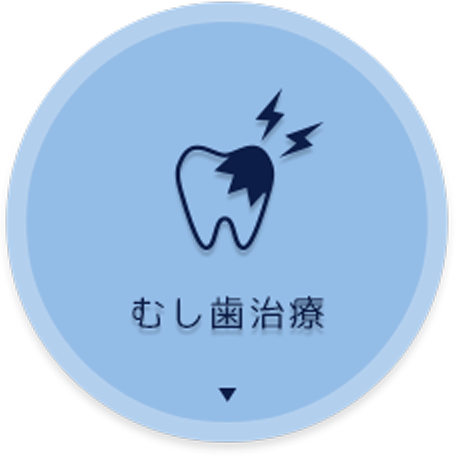 むし歯治療